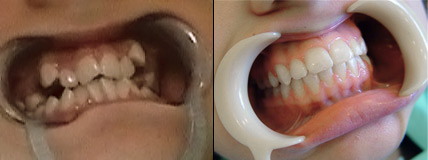 ortodoncja real